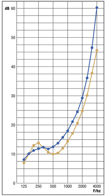 Akusztikai függöny